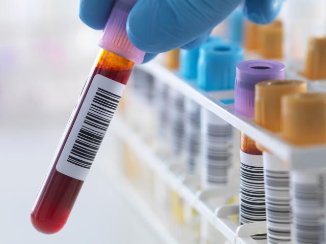 Hepatitis de origen desconocido en niños: 5 claves sobre lo que se sabe