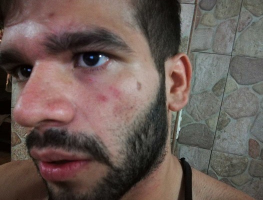 Denuncian intento de robo y golpes a periodista ante mirada indiferente de la PNB