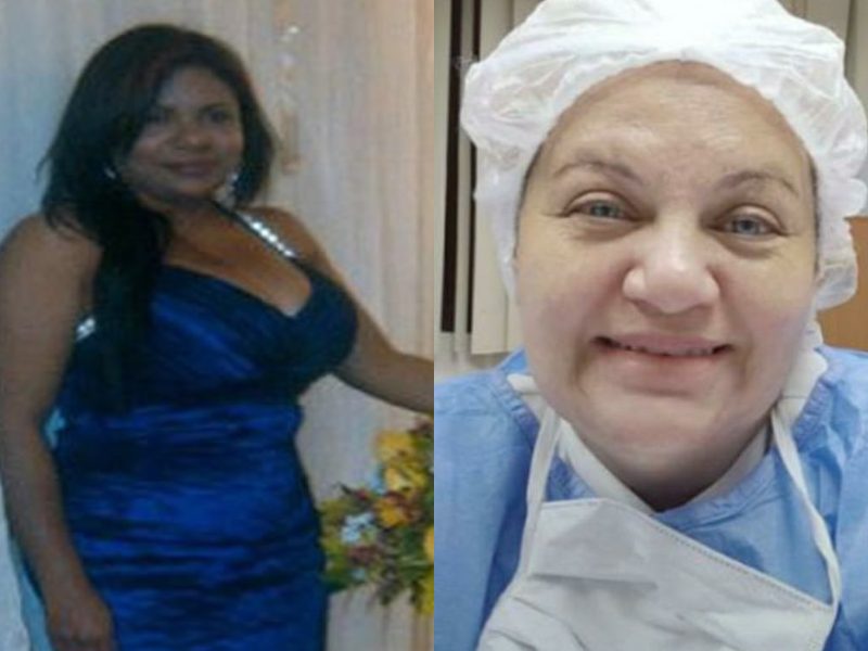 Mueren una anestesióloga y una enfermera por COVID-19 en Monagas y Caracas