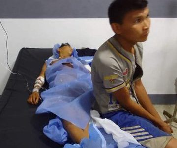 El adolescente herido en Parima B ha sido sometido a tres intervenciones quirúrgicas debido a que recibió tres impactos de bala. Testigos claves
