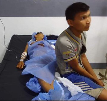 El adolescente herido en Parima B ha sido sometido a tres intervenciones quirúrgicas debido a que recibió tres impactos de bala. Testigos claves