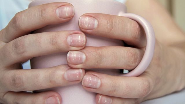 Uñas