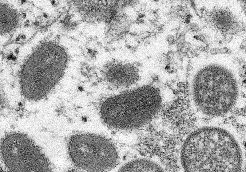 ¿Debería preocuparnos la viruela del mono?: 8 claves que debe saber