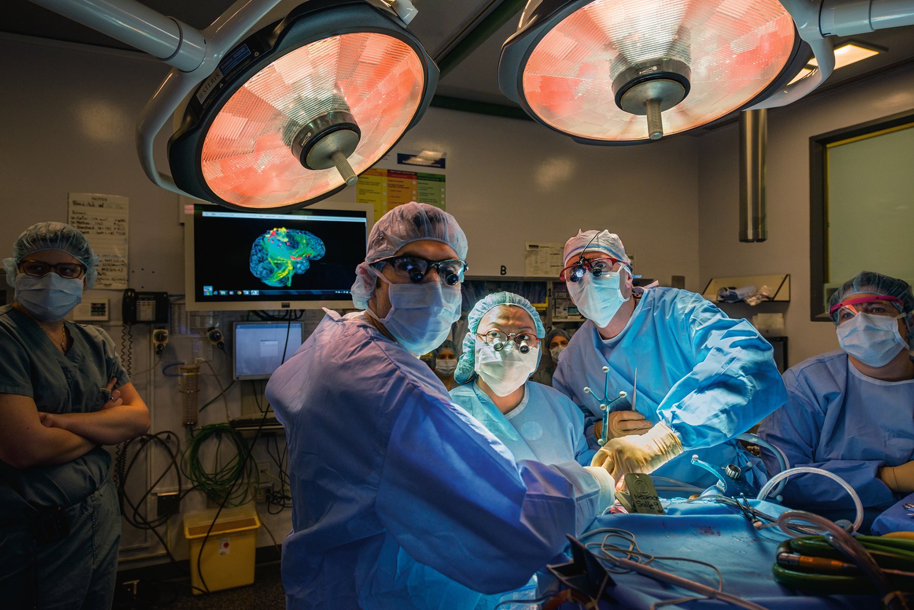 Cirugía a un cerebro humano