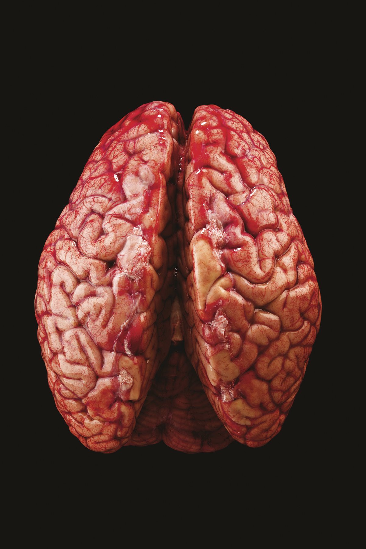 El cerebro humano
