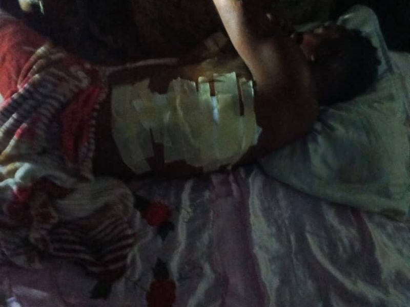 Una persona herida deja derrumbe de una mina en la Gran Sabana