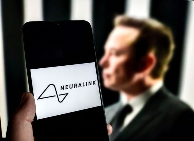 Cómo funciona Telepathy, el chip cerebral que Elon Musk asegura que se ...
