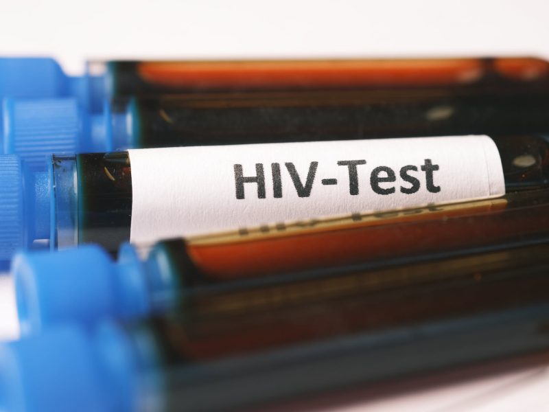 blood samples for hiv test